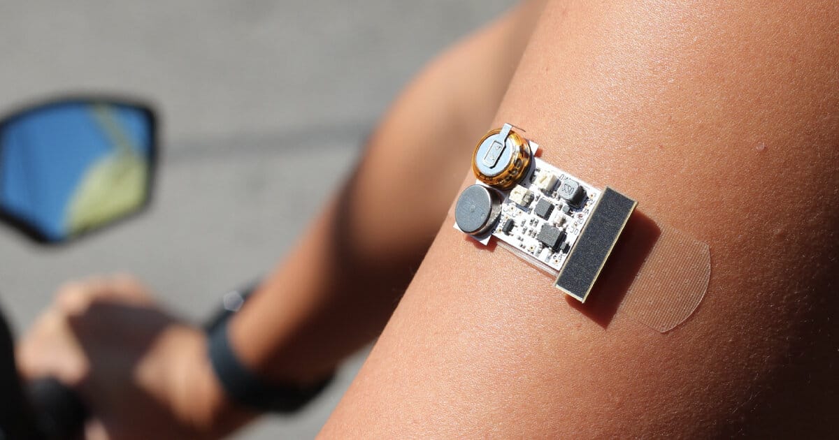 يمكن للضمادة القابلة للارتداء المزودة بالخلية الشمسية اكتشاف المدة التي قضاها المستخدم في حمامات الشمس